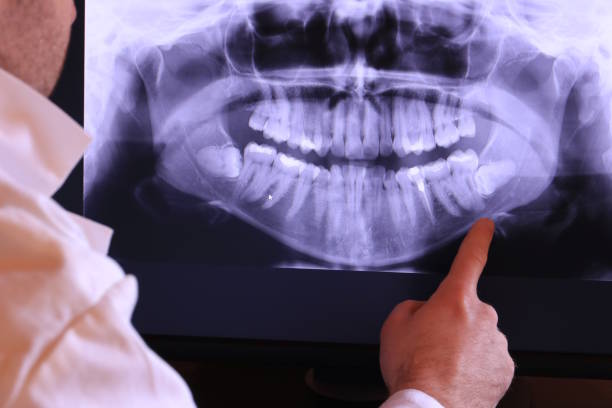 Best Emergency Treatment for Oral Infections in Bayview, CA