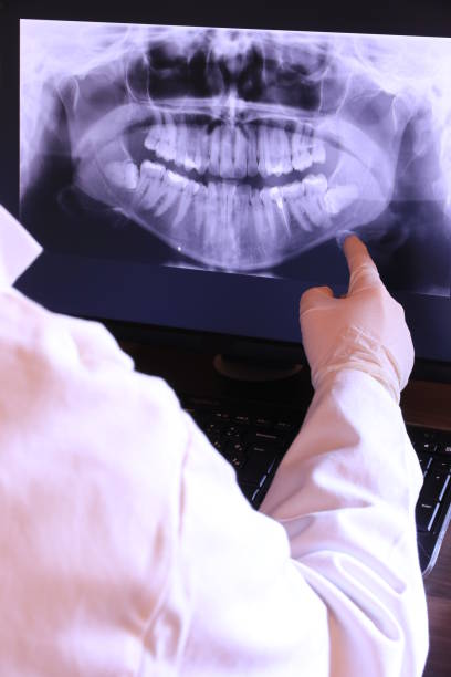 Best Broken or Chipped Tooth Repair in Bayview, CA
